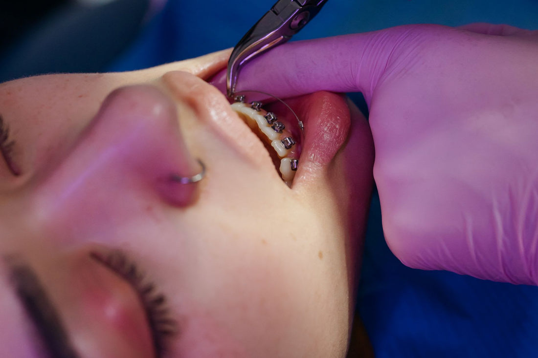 Amish Teeth Removal Tradition