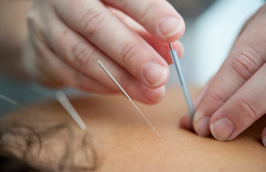 Can Christians Do Acupuncture