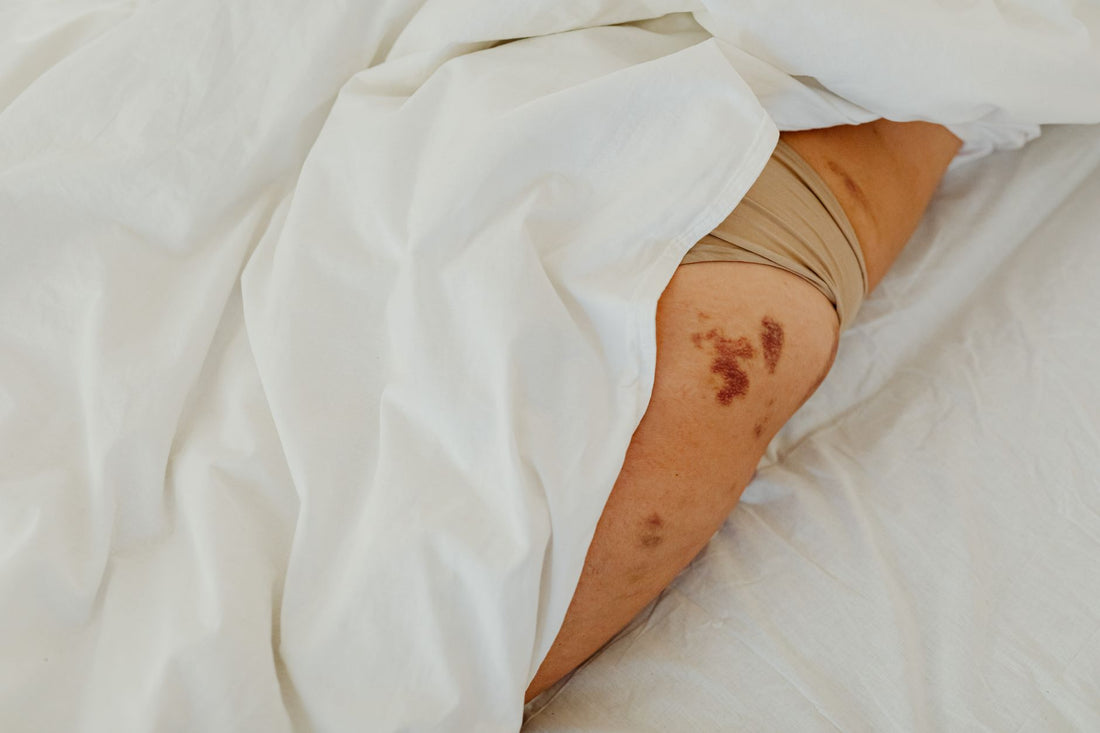 Can God Heal Hsv