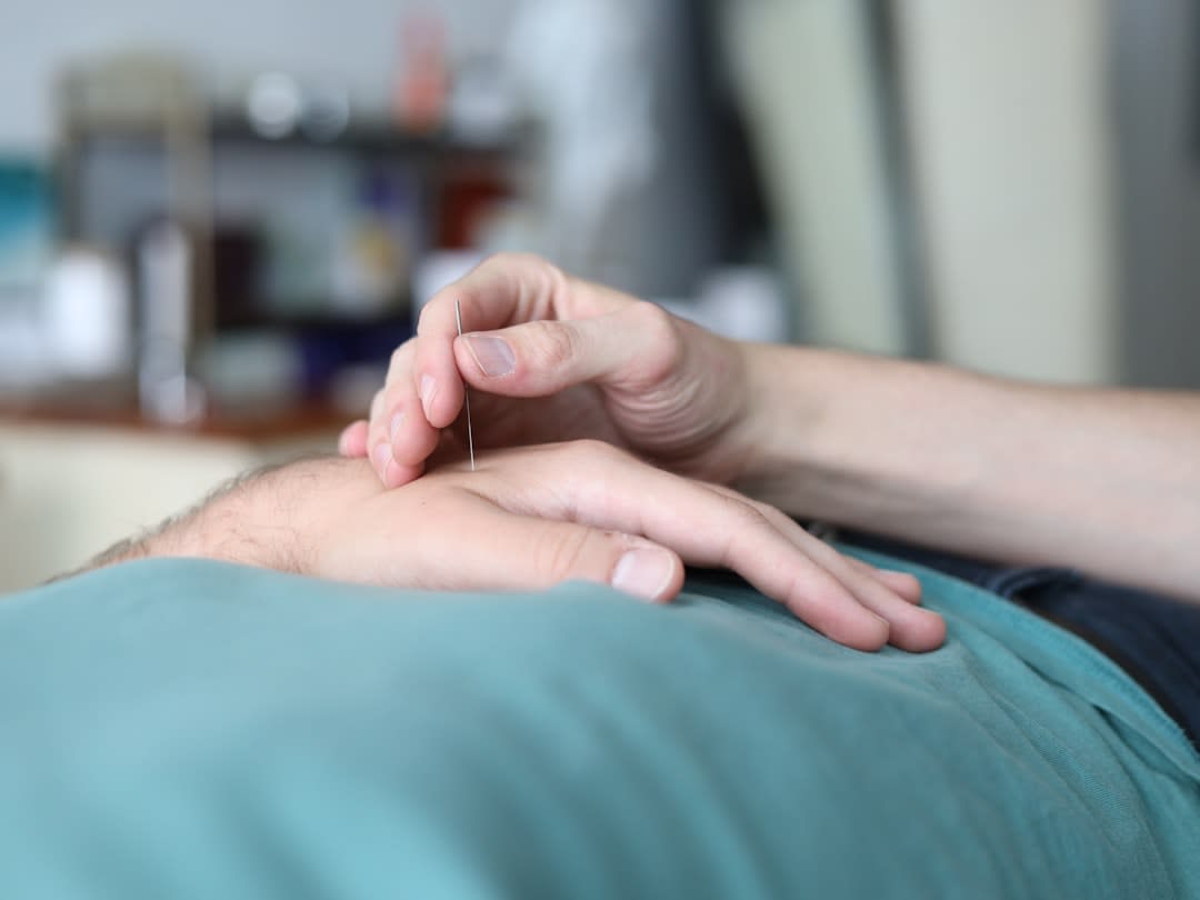 Should Christians Do Acupuncture