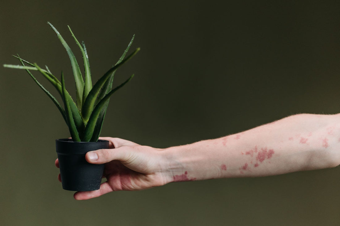 What Do The Amish Do for Eczema